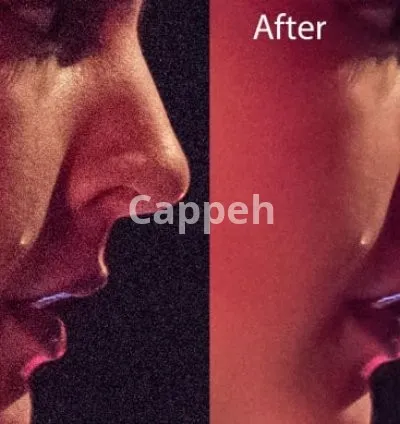 I will remove grain and denoise,flicker, dead pixel in your videos